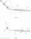 Fig. 15 - Introducer assembly particularly for balloon catheters