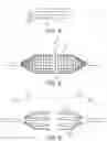 Fig. 04 - Inflatable medical balloon with flex points due to interrupted fibers
