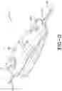 Fig. 04 - BALLOON CATHETER WITH ADJUSTABLE SHEATH