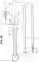 Fig. 06 - BALLOON CATHETER SYSTEM AND METHOD FOR OPTICAL TUMOR TREATMENT