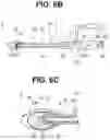 Fig. 07 - BALLOON CATHETER SYSTEM AND METHOD FOR OPTICAL TUMOR TREATMENT