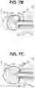 Fig. 09 - BALLOON CATHETER SYSTEM AND METHOD FOR OPTICAL TUMOR TREATMENT