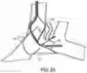 Fig. 07 - System and method for treating pulmonary edema