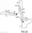 Fig. 18 - System and method for treating pulmonary edema