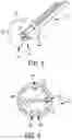 Fig. 04 - System and method for treating pulmonary edema