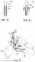 Fig. 06 - System and method for treating pulmonary edema