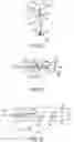 Fig. 17 - System and method for treating pulmonary edema