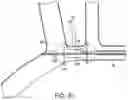 Fig. 22 - System and method for treating pulmonary edema