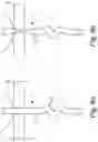 Fig. 07 - URETHRAL DEVICE