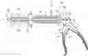 Fig. 01 - Treatment system and method for enlarging narrow portion