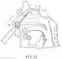 Fig. 11 - Treatment system and method for enlarging narrow portion