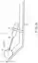 Fig. 12 - Treatment system and method for enlarging narrow portion