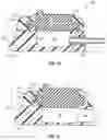 Fig. 07 - Assemblies for Identifying a Power Injectable Access Port