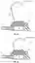 Fig. 23 - Assemblies for Identifying a Power Injectable Access Port