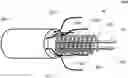 Fig. 01 - Intraseptal multi-electrode cardiac pacemaker and methods of use thereof