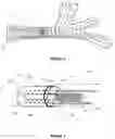 Fig. 03 - Intraseptal multi-electrode cardiac pacemaker and methods of use thereof