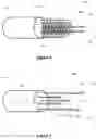 Fig. 05 - Intraseptal multi-electrode cardiac pacemaker and methods of use thereof