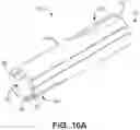 Fig. 14 - Imaging markers for stimulator leads