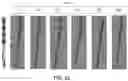 Fig. 19 - Imaging markers for stimulator leads