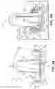 Fig. 07 - Medical device anchoring