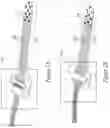 Fig. 02 - Biomedical device comprising a mechanically adaptive member