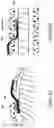 Fig. 05 - Biomedical device comprising a mechanically adaptive member