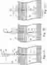 Fig. 08 - Percutaneous access for systems and methods of treating sleep-related disordered breathing