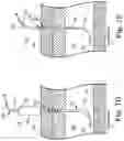 Fig. 09 - Percutaneous access for systems and methods of treating sleep-related disordered breathing
