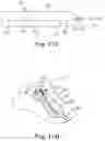 Fig. 15 - Percutaneous access for systems and methods of treating sleep-related disordered breathing