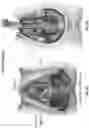 Fig. 05 - System and Method For Electrical Stimulation of Anorectal Structures To Treat Urinary Dysfunction