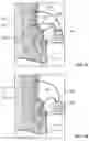 Fig. 14 - System and Method For Electrical Stimulation of Anorectal Structures To Treat Urinary Dysfunction
