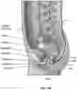 Fig. 15 - System and Method For Electrical Stimulation of Anorectal Structures To Treat Urinary Dysfunction
