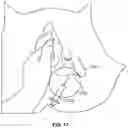 Fig. 24 - System and Method For Electrical Stimulation of Anorectal Structures To Treat Urinary Dysfunction