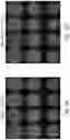 Fig. 08 - Systems and methods for predicting optimal deep brain stimulation parameters