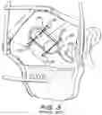 Fig. 04 - FIXATION SYSTEM FOR AN IMPLANTABLE MEDICAL DEVICE