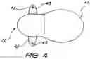 Fig. 05 - FIXATION SYSTEM FOR AN IMPLANTABLE MEDICAL DEVICE