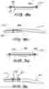 Fig. 08 - FIXATION SYSTEM FOR AN IMPLANTABLE MEDICAL DEVICE