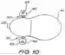 Fig. 09 - FIXATION SYSTEM FOR AN IMPLANTABLE MEDICAL DEVICE