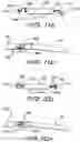 Fig. 10 - FIXATION SYSTEM FOR AN IMPLANTABLE MEDICAL DEVICE