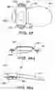 Fig. 12 - FIXATION SYSTEM FOR AN IMPLANTABLE MEDICAL DEVICE