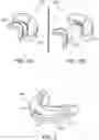 Fig. 02 - TEEETH WHITENING DEVICE AND METHOD