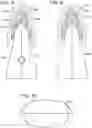Fig. 06 - TEEETH WHITENING DEVICE AND METHOD