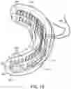 Fig. 10 - TEEETH WHITENING DEVICE AND METHOD