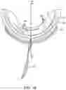 Fig. 11 - TEEETH WHITENING DEVICE AND METHOD