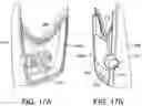 Fig. 12 - TEEETH WHITENING DEVICE AND METHOD