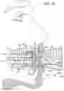 Fig. 14 - TEEETH WHITENING DEVICE AND METHOD