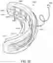 Fig. 15 - TEEETH WHITENING DEVICE AND METHOD
