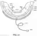 Fig. 16 - TEEETH WHITENING DEVICE AND METHOD