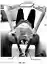 Fig. 05 - A couch-mounted stereoscopic surface imaging and biofeedback system