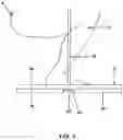 Fig. 04 - Apparatus for exercising a person's legs